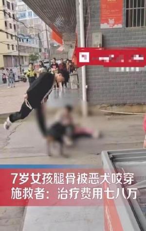 引众怒！恶犬撕咬女孩不松口，狗主人跪地 道歉，医疗费高达八万-图4