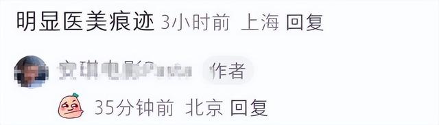 黄晓明乘坐地铁被偶遇，面部医美痕迹明显，假发套太抢镜